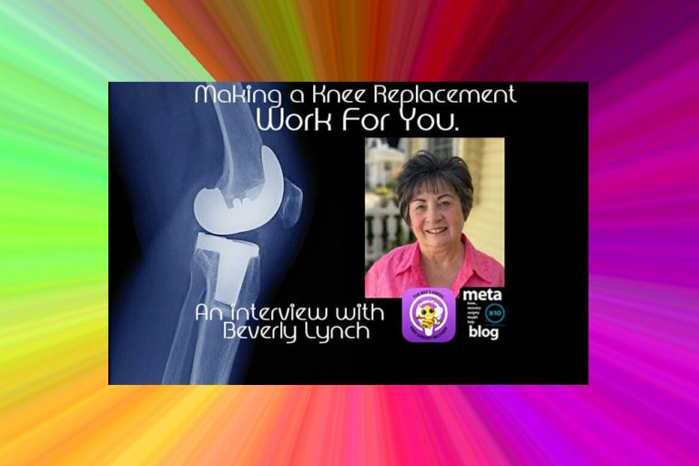 Beverly-Lynch's-Knee-Replacement