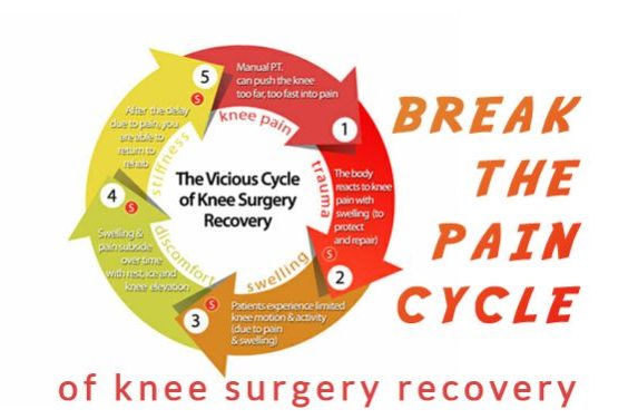 Knee Rehab: Too Much Pain