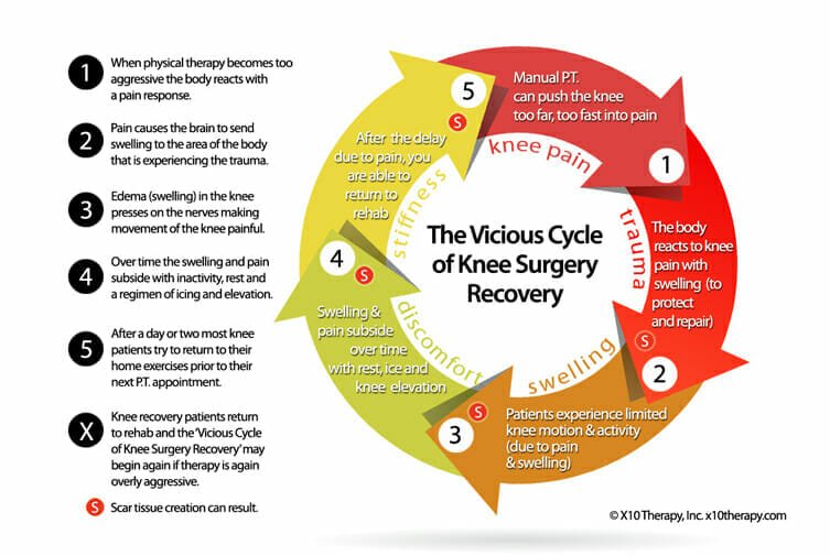 Vicious-Cycle-of-Knee-Surgery-Recovery Vicious-Cycle-of-Knee-Surgery-Recovery