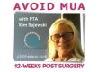 Avoid Manipulation Under Anesthesia with-PTA-Kim-Sajewski