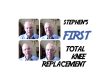 STEPHEN-HANSEN-STEPHENS-FIRST-TOTAL-KNEE-REPLACEMENT