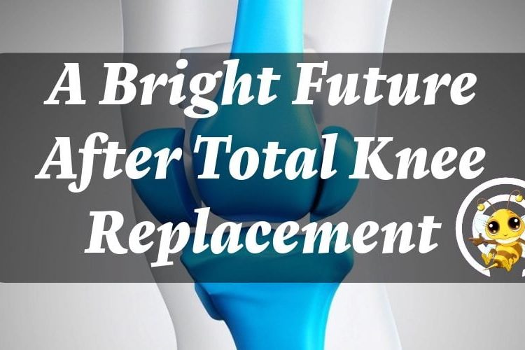 77 year old knee replacement | Nancy's Story